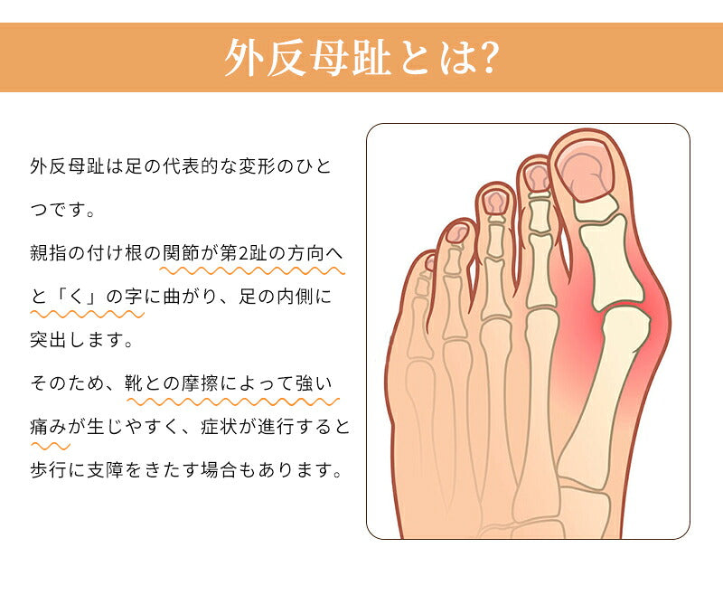 外反母趾 足指セパレーター サポーター フットケア 内反小趾 指 小指 矯正 足指サポーター 外反母趾サポーター 親足 アーチ 寝指 浮き指 左足 右足 足の痛み 五段階調整 内反小趾サポーター 広げる 靴下 浮指 足指 セパレーター 左右セット 衝撃 吸収 保護 サポーター補正
