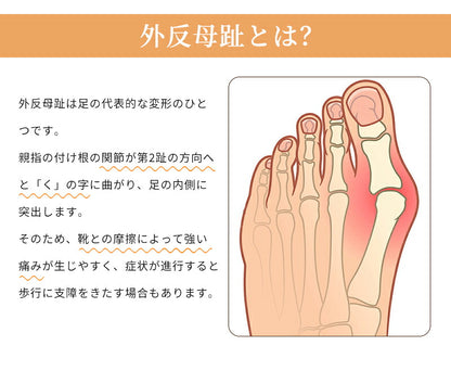 外反母趾 足指セパレーター サポーター フットケア 内反小趾 指 小指 矯正 足指サポーター 外反母趾サポーター 親足 アーチ 寝指 浮き指 左足 右足 足の痛み 五段階調整 内反小趾サポーター 広げる 靴下 浮指 足指 セパレーター 左右セット 衝撃 吸収 保護 サポーター補正