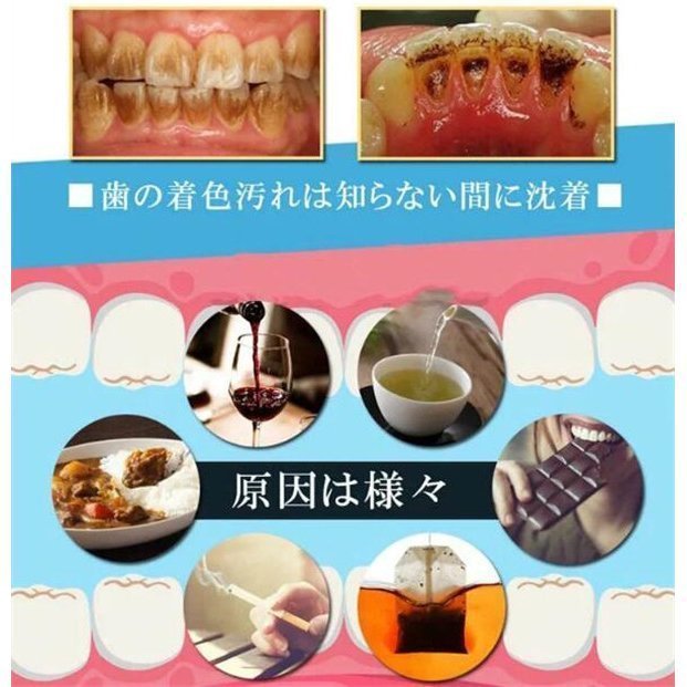 口腔洗浄器 超音波スケーラー口臭予防 歯周病予防 IPX6防水 口腔洗浄器歯用ツール 超音波デンタルクリーナー 歯石取り器具 口腔洗浄器 歯石取りスクレバー rt-1041