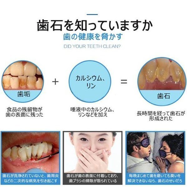 口腔洗浄器 超音波スケーラー口臭予防 歯周病予防 IPX6防水 口腔洗浄器歯用ツール 超音波デンタルクリーナー 歯石取り器具 口腔洗浄器 歯石取りスクレバー copysku-16
